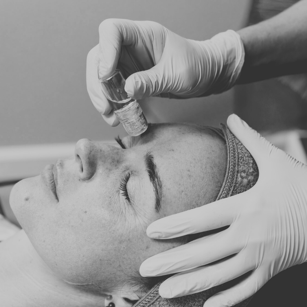 (Clinic) Micro-Infusion